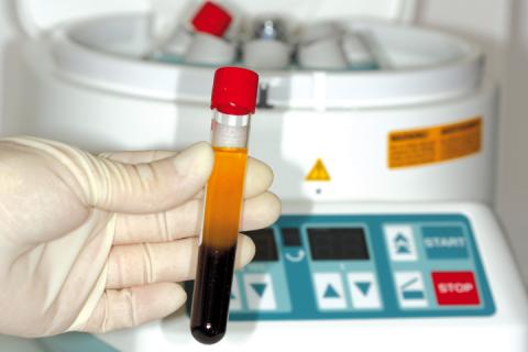 Центрифугирование крови для PRF